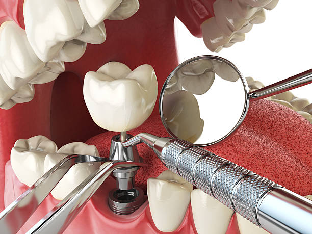 Best Emergency Tooth Extraction  in Millersport, OH